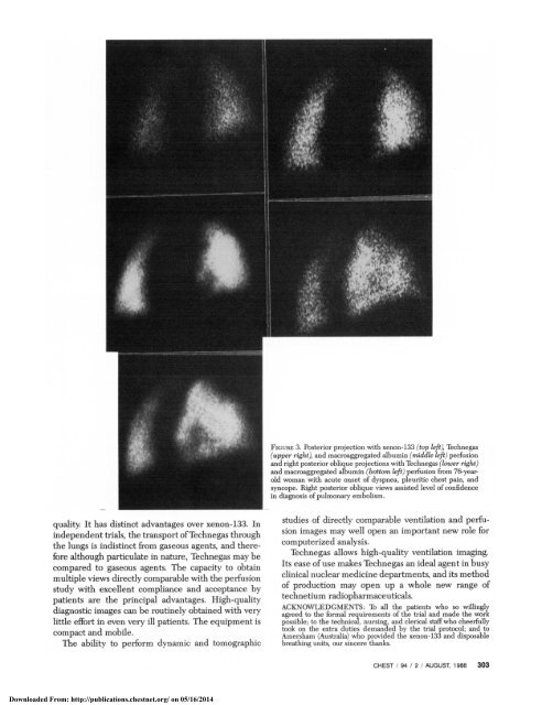 A Clinical Comparison of Technegas and Xenon-133 in 50 Patients ...