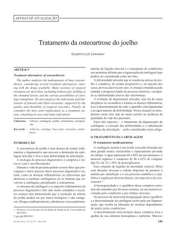 Tratamento da osteoartrose do joelho - SNC