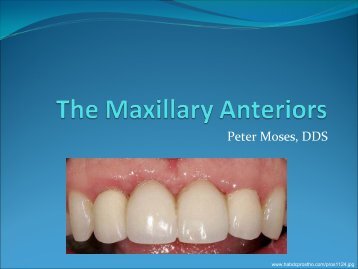 Internal Anatomy of Anterior Teeth