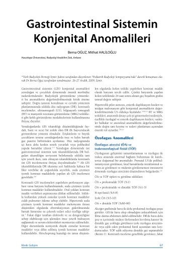 Gastrointestinal Sistemin Konjenital Anomalileri - Klinik GeliÅim