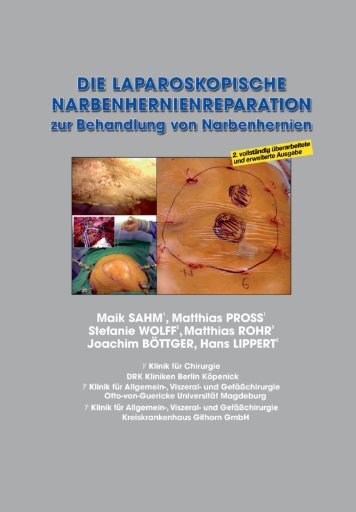 Die laparoskopische Narbenhernienreparation zur Behandlung von ...