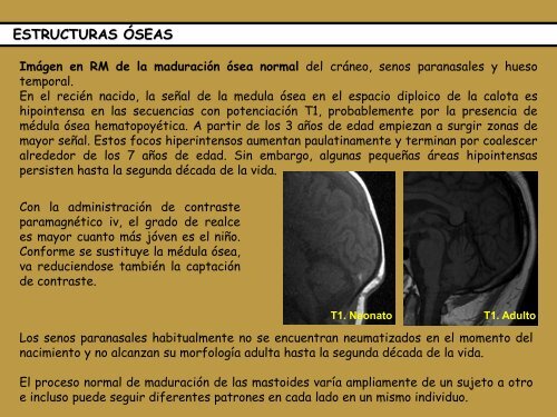 Estructuras Óseas