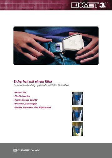 Das Certain Â® Implantat System - BIOMET 3i Allbiomet3i.at