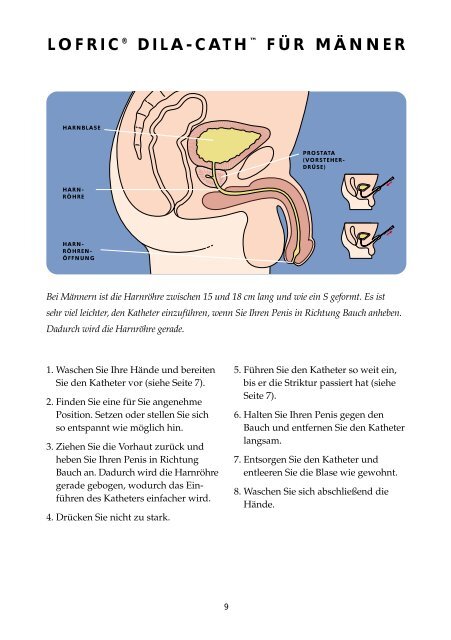 PATIENTENRATGEBER ZUR SELBSTDILATATION - Astra Tech