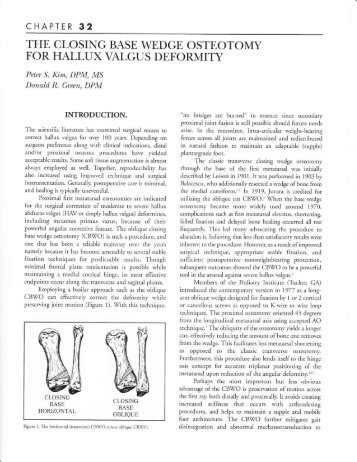 The Closing Base Wedge Osteotomy for Hallux Valgus