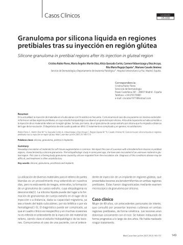 Granuloma por silicona lÃ­quida en regiones ... - edigraphic.com