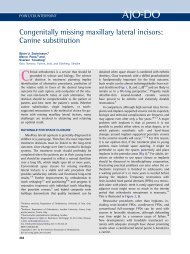 Congenitally missing maxillary lateral incisors ... - ResearchGate