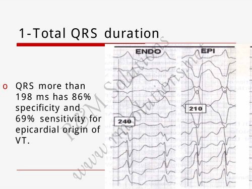 QRS amplitude - cardioegypt2011