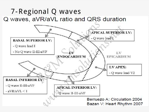 QRS amplitude - cardioegypt2011