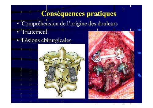 Anatomie du grand nerf occipital - sofmmoo