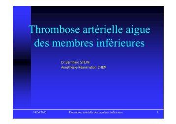 Thrombose artÃ©rielle aigue des membres infÃ©rieures