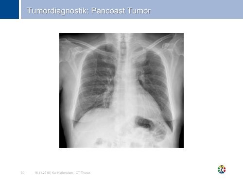 CT Thorax