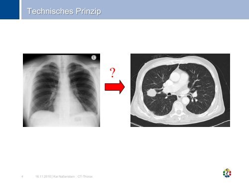 CT Thorax