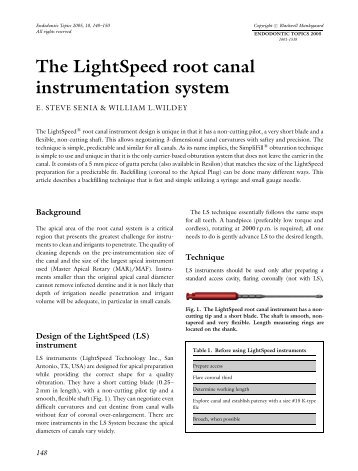 The LightSpeed root canal instrumentation system - Wiley Online ...