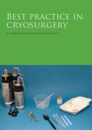 Best practice in cryosurgery - BDNG