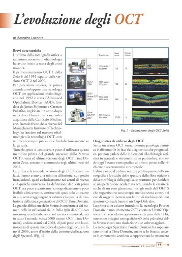 L'evoluzione degli OCT - Studio Oculistico dott. Amedeo Lucente