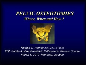 Pelvic Osteotomies - CHU Sainte-Justine - SAAC