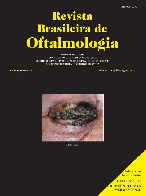 nº 4 - Julho / Agosto 2010 - Sociedade Brasileira de Oftalmologia