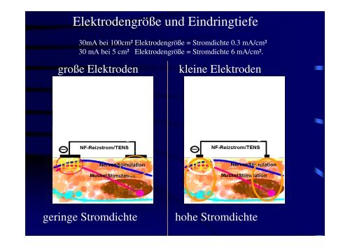 Teil 4 (TENS & AST)