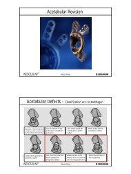 Acetabular Revision - MEDICURE implantes