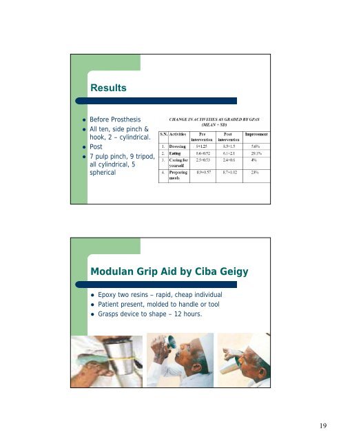 Leprosy â Prosthetic implications