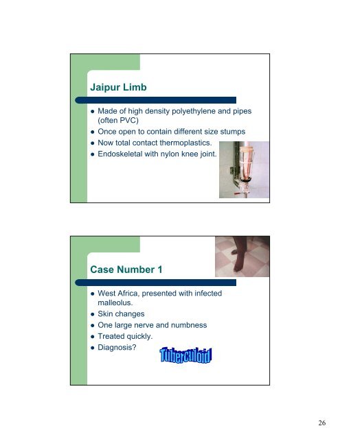 Leprosy â Prosthetic implications