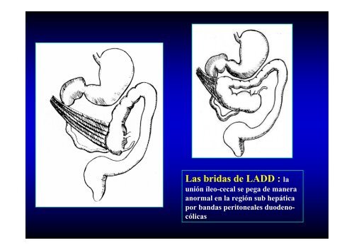 ABDOMEN AGUDO LO QUE SE DEBE Y NO SE DEBE HACER