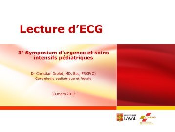 Lecture d'ECG - CHU Sainte-Justine - SAAC
