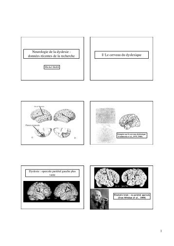 Le cerveau du dyslexique - Resodys