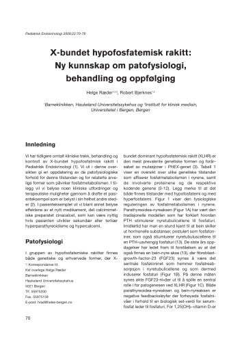 X-bundet hypofosfatemisk rakitt - Pediatrisk Endokrinologi
