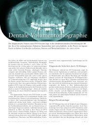 Dentale Volumentomographie - KaVo