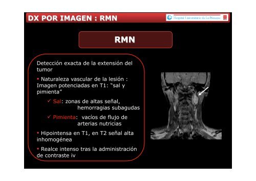 POSTER DE PARAGANGLIOMAS 28 ABRIL