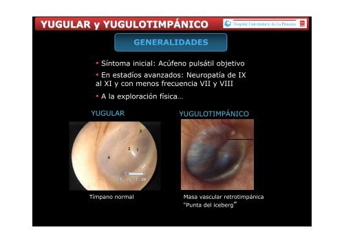 POSTER DE PARAGANGLIOMAS 28 ABRIL