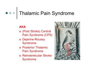 Thalamic Pain Syndrome