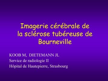Imagerie cÃ©rÃ©brale de la sclÃ©rose tubÃ©reuse de Bourneville