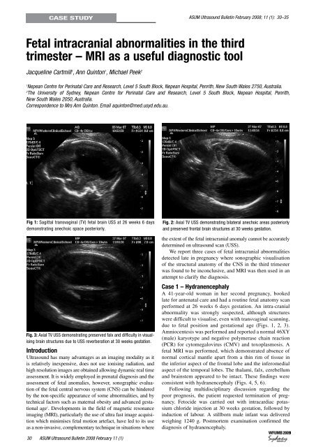 Volume 11 Issue 1 (February) - Australasian Society for Ultrasound ...