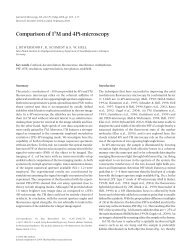 Comparison of I5M and 4Pi-microscopy