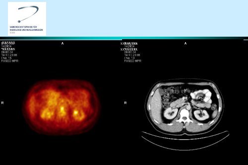 pet/ct - Gemeinschaftspraxis fÃ¼r Radiologie und Nuklearmedizin