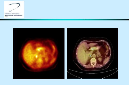 pet/ct - Gemeinschaftspraxis fÃ¼r Radiologie und Nuklearmedizin