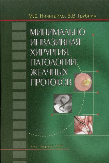 Слепое зондирование яйцами. Тюбаж с сорбитом для чистки печени (слепое зондирование)