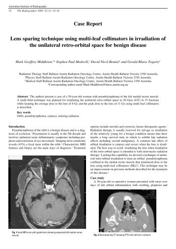 Case Report Lens sparing technique using multi ... - Minnis Journals