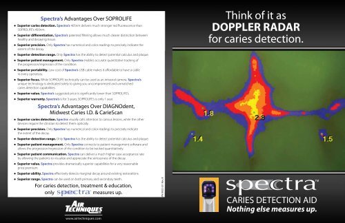 Think of it as DOPPLER RADAR for caries detection.