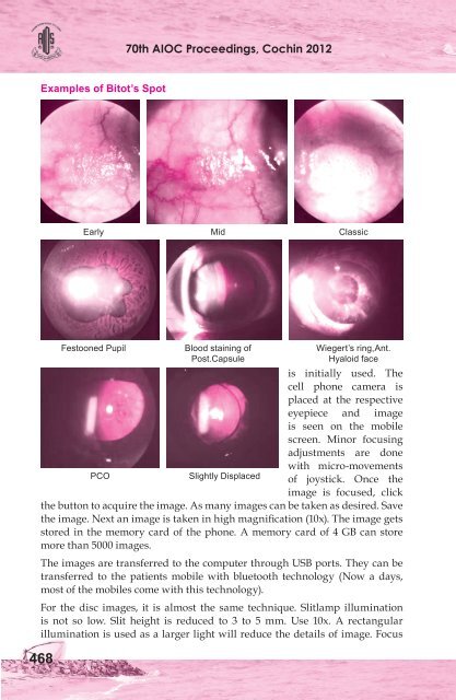 Comprehensive Ophthalmology Free Papers - aioseducation