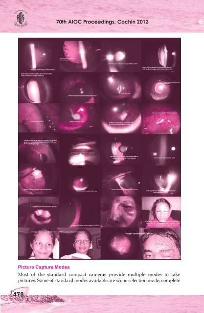 Comprehensive Ophthalmology Free Papers - aioseducation