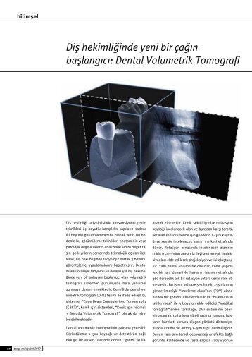 Dental Volumetrik Tomografi