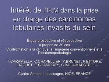 en charge des carcinomes lobulaires invasifs du sein