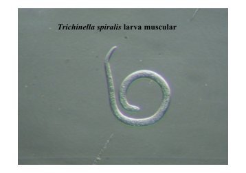 Trichinella spp.