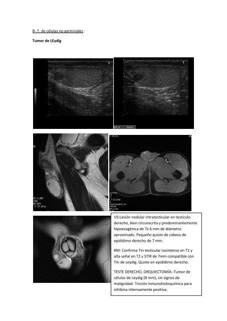 aportación de la rm en el diagnostico diferencial de la patología ...