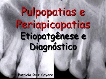 Pulpopatias e periapicopatias - PatrÃ­cia Ruiz Spyere