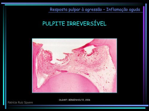 Pulpopatias e periapicopatias - PatrÃ­cia Ruiz Spyere
